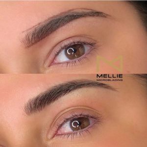 Microblading